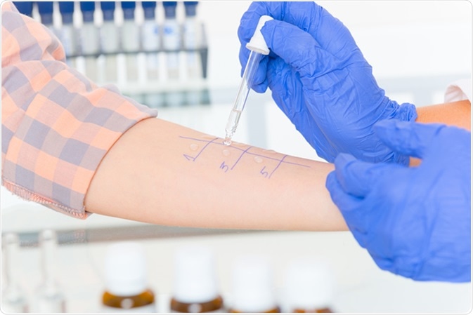 Doctor doing allergy tests. Image Credit: Monika Wisniewska / Shutterstock